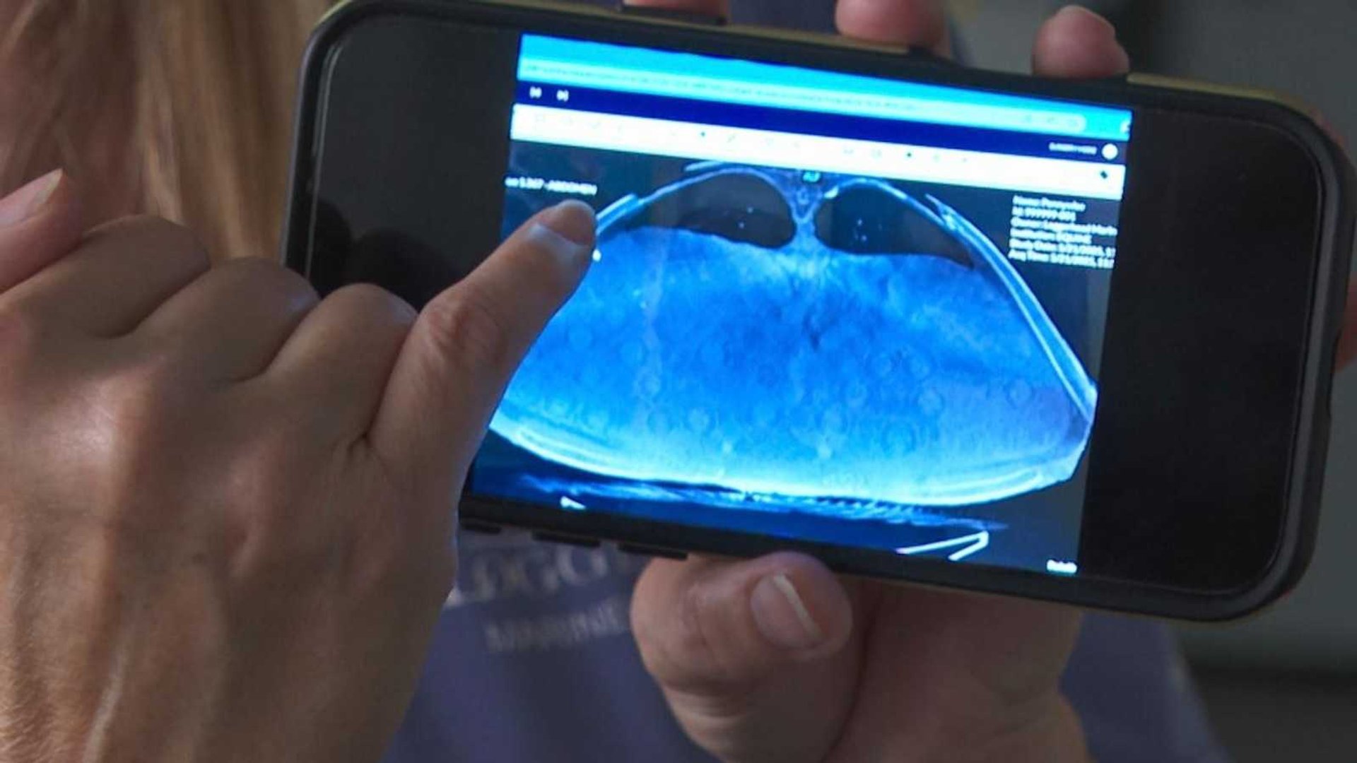 Rescued 302-Pound Loggerhead Sea Turtle Reveals Egg Surprise After CT Scan
