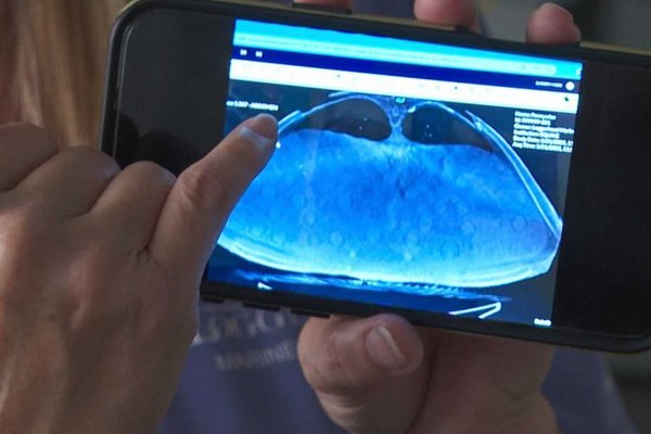 Rescued 302-Pound Loggerhead Sea Turtle Reveals Egg Surprise After CT Scan